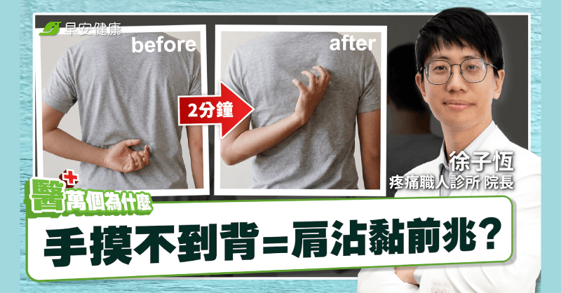 抓不到背小心肱骨前移！醫揭自測方法，4招鬆開肩膀還你活動度!!